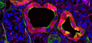 01-09-15-investigación fibrosis renal