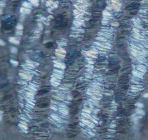 La superficie del cartílago articular, sobre fibras colágenas del cartílago que han sido alteradas por un proceso de artrosis muy precoz. Aquí los cristales forman filas muy ordenadas a lo largo de ondulaciones en bandas de colágeno