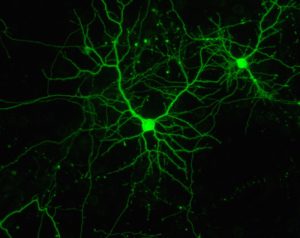 01-02-17-neuronas inhibidores del cerebro