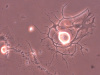 DRG-neuron-2